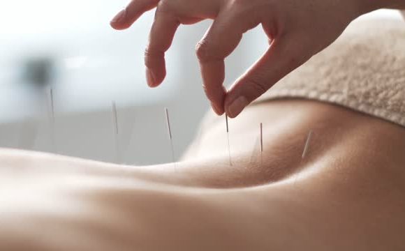 Medicina Tradicional Chinesa